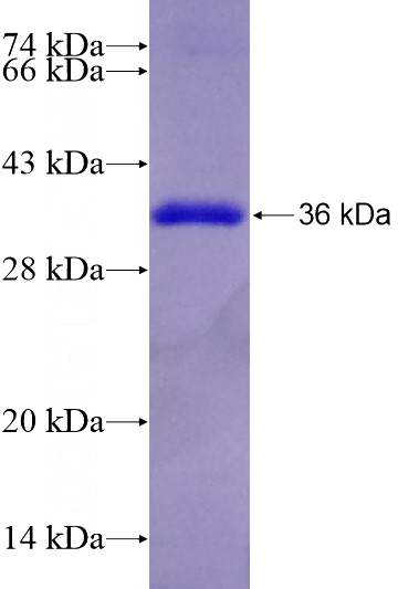 Recombinant Human NCK2 SDS-PAGE