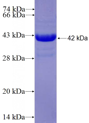 Recombinant Human GRP SDS-PAGE
