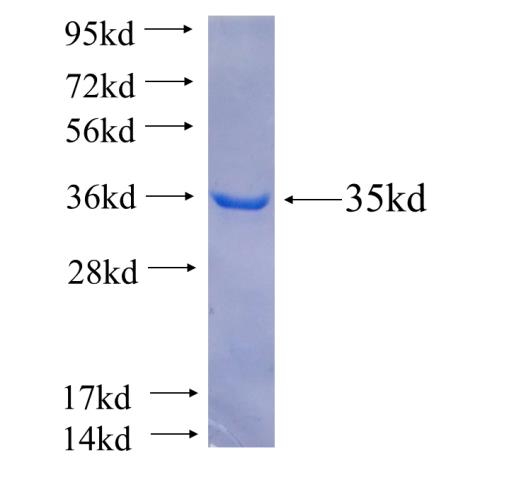 Recombinant human PSMB10(Full length) SDS-PAGE