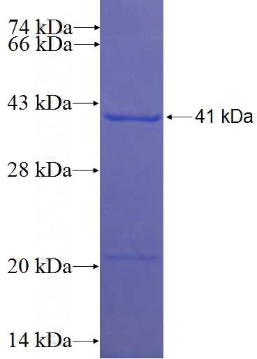 Recombinant Human TTC17 SDS-PAGE