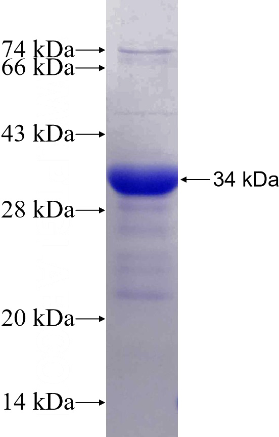 Recombinant Human ZSCAN4 SDS-PAGE