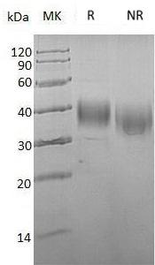 Human ASGR1/CLEC4H1 (His tag) recombinant protein