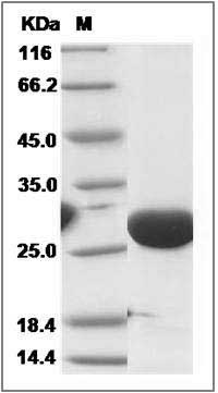 Human Phosphomannomutase 2 / PMM2 / CDG1 Protein (His Tag) SDS-PAGE
