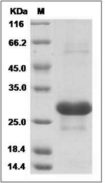 Human Interferon alpha-B / IFNA8 Protein (His Tag) SDS-PAGE