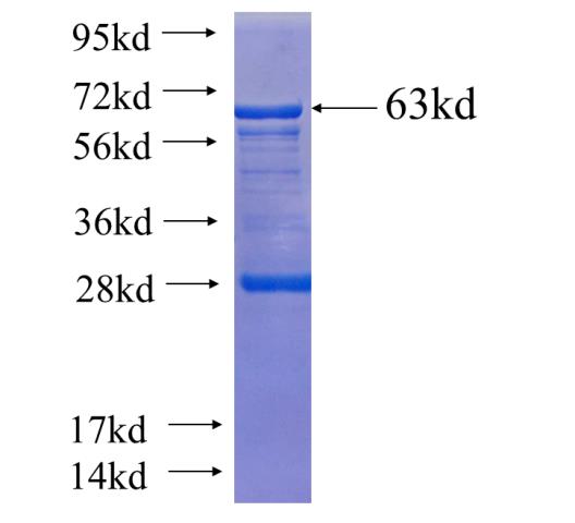 Recombinant human TCOF1 SDS-PAGE