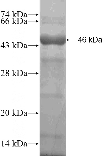 Recombinant Human ZNF311 SDS-PAGE