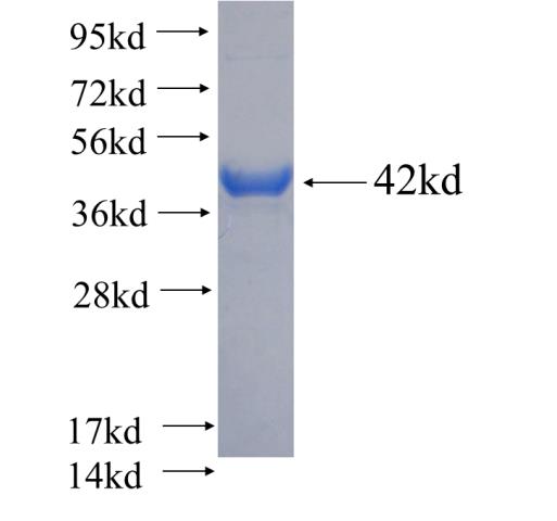 Recombinant human EMILIN1 SDS-PAGE