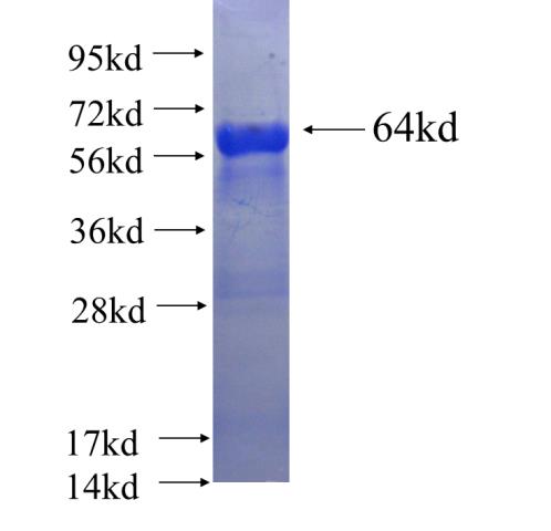 Recombinant human PELO SDS-PAGE