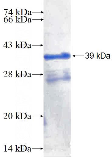 Recombinant Human Supervillin SDS-PAGE