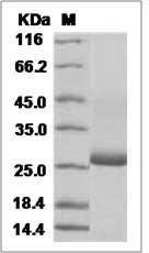 Human AMBP / Alpha 1 microglobulin Protein (His Tag)