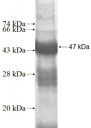 Recombinant Human ANAPC10 SDS-PAGE
