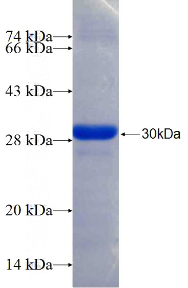 Recombinant Human KIF13A SDS-PAGE