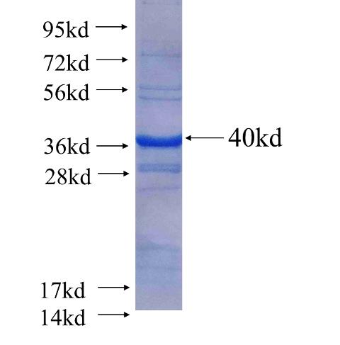 Recombinant human NAT1(Full length) SDS-PAGE