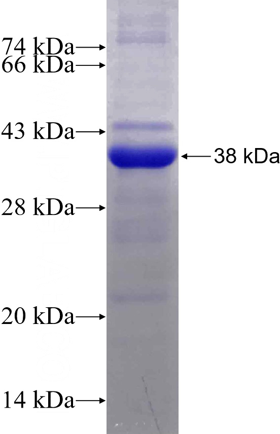 Recombinant Human PLEKHO1 SDS-PAGE