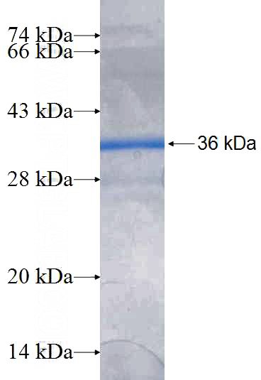Recombinant Human VAMP8 SDS-PAGE