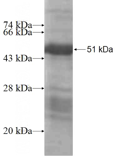 Recombinant Human GRAP SDS-PAGE