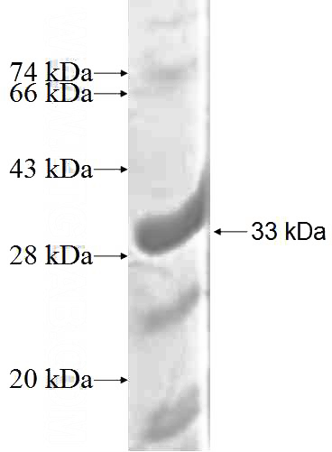 Recombinant Human CENPH SDS-PAGE