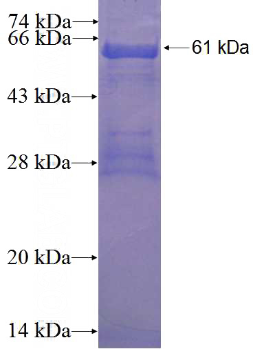 Recombinant Human AMDHD2 SDS-PAGE