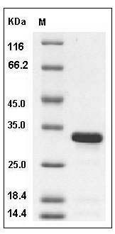 Mouse BCL2L1 / Bcl-XL Protein (aa 1-212, His Tag) SDS-PAGE