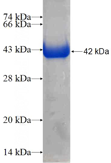 Recombinant Human TCTN2 SDS-PAGE