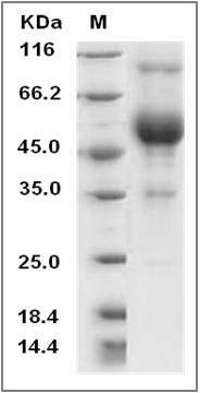 Rat CD83 Protein (Fc Tag) SDS-PAGE