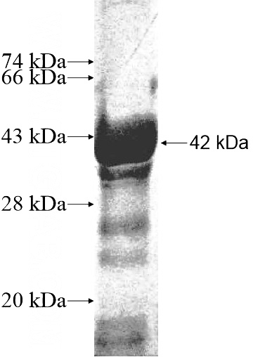 Recombinant Human ME3 SDS-PAGE