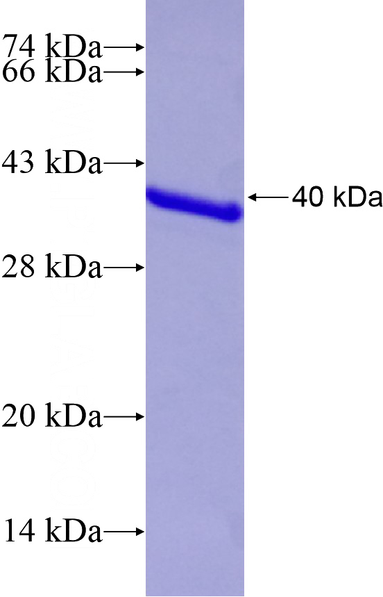 Recombinant Human SNAPC1 SDS-PAGE