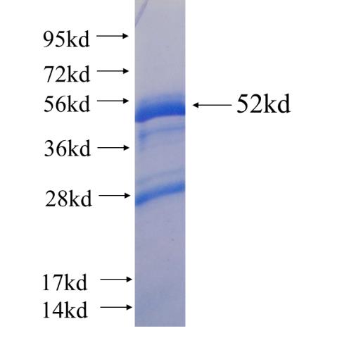 Recombinant human SETBP1(Full length) SDS-PAGE