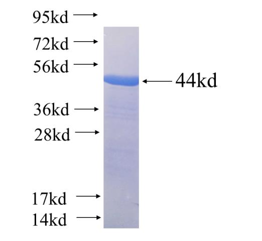 Recombinant human DGKH SDS-PAGE