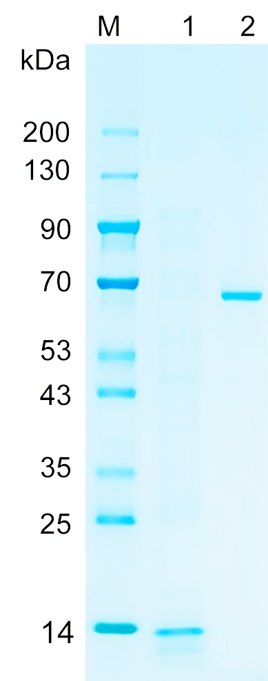 Recombinant JUNB protein (His tag) SDS-PAGE