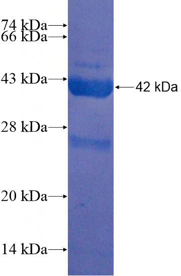 Recombinant Human C2orf79 SDS-PAGE