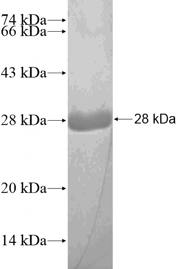 Recombinant Human ATXN3L SDS-PAGE
