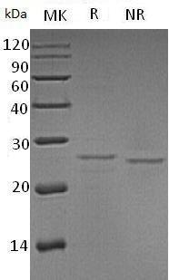 Human EIF4E/EIF4EL1/EIF4F recombinant protein