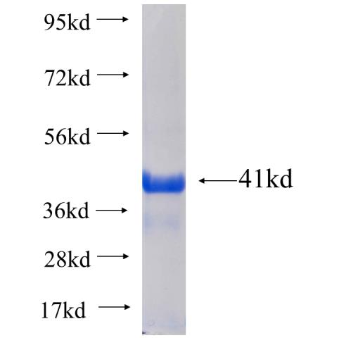 Recombinant human SIGLEC9 SDS-PAGE