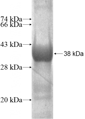 Recombinant Human LIX1 SDS-PAGE
