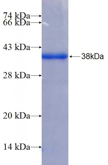 Recombinant Human SERCA2,ATP2A2 SDS-PAGE