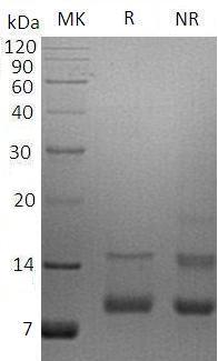 Human PPBP/CTAP3/CXCL7/SCYB7/TGB1/THBGB1 recombinant protein