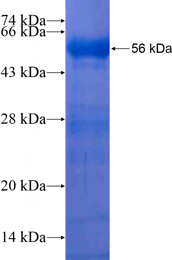 Recombinant Human MEFV SDS-PAGE