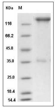 Human SELP / selectin P / P-selectin Protein (Fc Tag) SDS-PAGE