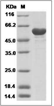 Mouse PKM2 / OIP3 Protein (His Tag) SDS-PAGE