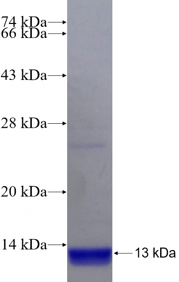 Recombinant Human C13orf37 SDS-PAGE