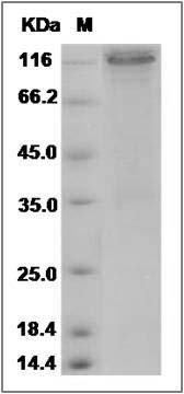 Rat E-Cadherin / CDH1 / E-cad / CD324 Protein (Fc Tag) SDS-PAGE