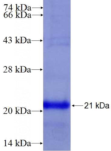 Recombinant Human SLC44A1 SDS-PAGE