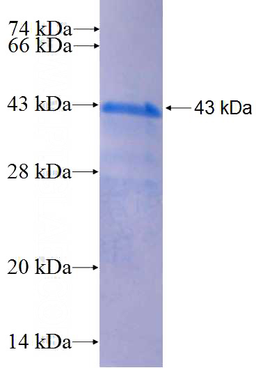 Recombinant Human VPS37C SDS-PAGE