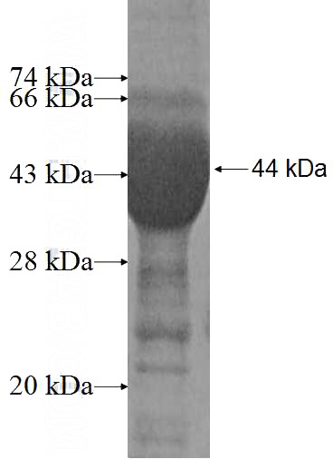 Recombinant Human MGAT4B SDS-PAGE