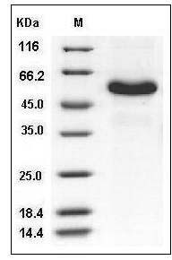 Human TNFRSF25 / DR3 / TNFRSF12 Protein (Fc Tag) SDS-PAGE