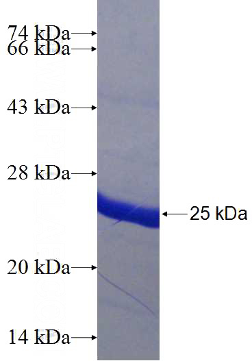 Recombinant Human KRT5 SDS-PAGE