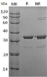 Human SULT1A3 (His tag) recombinant protein