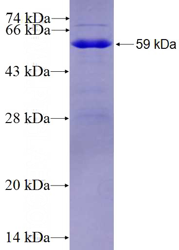 Recombinant Human RASSF8 SDS-PAGE