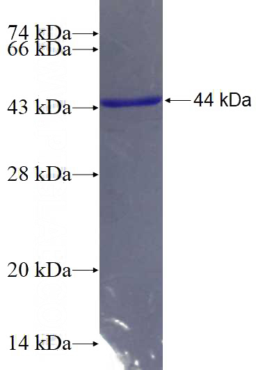 Recombinant Human UBD SDS-PAGE